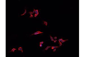 ABIN6266773 staining HeLa  cells by IF/ICC.