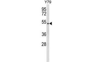 Western blot analysis of GTF2H4 Antibody (Center) in Y79 cell line lysates (35ug/lane).