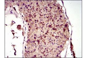 Immunohistochemical analysis of paraffin-embedded testis tissues using MAP1LC3A mouse mAb with DAB staining. (MAP1LC3A anticorps  (AA 1-121))