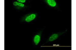 Immunofluorescence of monoclonal antibody to CARF on HeLa cell. (CDKN2AIP anticorps  (AA 1-579))
