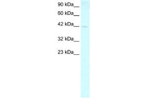WB Suggested Anti-FOXP1 Antibody Titration:  0. (FOXP1 anticorps  (N-Term))