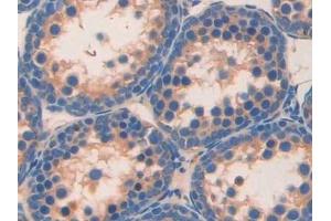 anti-Resistin (RETN) (AA 21-114) antibody