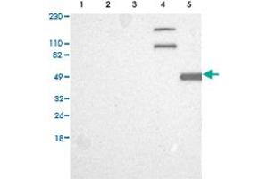 Western Blot analysis of (1) Human RT-4 cell, (2) Human U-251MG sp cell, (3) Human A-431 cell, (4) Human liver tissue, (5) Human tonsil tissue. (CAPN10 anticorps)