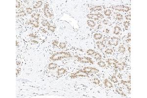 Immunohistochemistry (IHC) image for anti-AT Rich Interactive Domain 1B (SWI1-Like) (ARID1B) (AA 1425-1475) antibody (ABIN7795694)