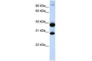 Western Blot showing ZNF138 antibody used at a concentration of 1-2 ug/ml to detect its target protein. (ZNF138 anticorps  (C-Term))