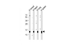 All lanes : Anti-S100A9 Antibody (Center) at 1:500-1:1000 dilution Lane 1: human breast lysate Lane 2: human heart lysate Lane 3: human lung lysate Lane 4: human spleen lysate Lysates/proteins at 20 μg per lane. (S100A9 anticorps  (AA 22-56))