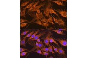 Immunofluorescence analysis of C6 cells using SDHB Rabbit pAb (ABIN6131588, ABIN6147472, ABIN6147474 and ABIN6215002) at dilution of 1:100.