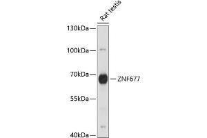 Western blot analysis of extracts of rat testis, using ZNF677 antibody (ABIN7271518) at 1:1000 dilution. (ZNF677 anticorps  (AA 50-200))