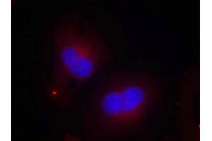 Immunofluorescence staining of methanol-fixed Hela cells using FAK(Phospho-Tyr925) Antibody. (FAK anticorps  (pTyr925))