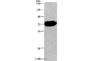 Western blot analysis of Human pancreas tissue, using CDC16 Polyclonal Antibody at dilution of 1:250 (CDC16 anticorps)