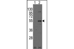 Western blot analysis of Dtnbpt(arrow) using rabbit polyclonal Dysbindin(Dtnbp1) Antibody (N-term) (ABIN389169 and ABIN2839335). (DTNBP1 anticorps  (N-Term))