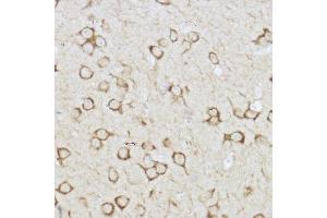 Immunohistochemistry of paraffin-embedded mouse brain using Raptor Rabbit pAb (ABIN7269901) at dilution of 1:150 (40x lens). (Raptor anticorps)