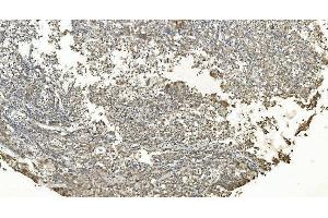 IHC analysis of FLCN using anti-FLCN antibody (ABIN7602491). (FLCN anticorps  (AA 8-551))