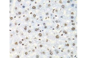 Immunohistochemistry of paraffin-embedded Mouse liver using IGF2BP2 Polyclonal Antibody at dilution of 1:100 (40x lens). (IGF2BP2 anticorps)