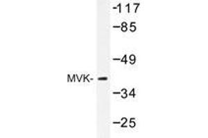Western blot analysis of MVK antibody in extracts from COS-7 cell. (MVK anticorps)