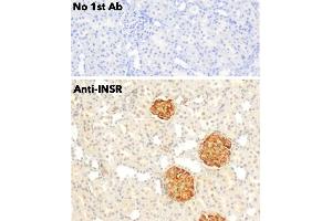 anti-Insulin Receptor (INSR) (C-Term) antibody