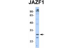 Host:  Rabbit  Target Name:  JAZF1  Sample Type:  Human Adult Placenta  Antibody Dilution:  1.