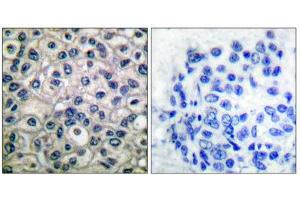 Immunohistochemistry (IHC) image for anti-Breast Cancer Anti-Estrogen Resistance 1 (BCAR1) (pTyr410) antibody (ABIN1847248) (BCAR1 anticorps  (pTyr410))