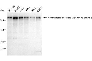 Western blotting analysis using Chromodomain helicase DNA binding protein 3 antibody (ABIN7798068). (Recombinant CHD3 anticorps)
