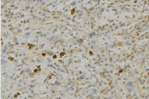 ABIN6276690 at 1/100 staining Human gastric tissue by IHC-P. (Peroxiredoxin 4 anticorps  (C-Term))
