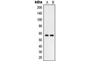 Western blot analysis of RHCG expression in NCIH460 (A), human testis (B) whole cell lysates. (RHCG anticorps  (Center))