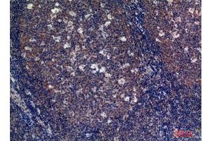 Immunohistochemistry (IHC) analysis of paraffin-embedded Human Tonsils, antibody was diluted at 1:100.