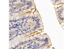 Immunohistochemistry analysis of paraffin-embedded rat colon using,NHE-3 (ABIN7075685) at dilution of 1: 1200