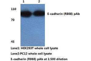 Western blot analysis of E-cadherin (pArg868) (E-cadherin anticorps)