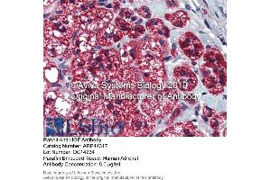 Immunohistochemistry (IHC) image for anti-Hepatocyte Growth Factor (Hepapoietin A, Scatter Factor) (HGF) (N-Term) antibody (ABIN405641) (HGF anticorps  (N-Term))