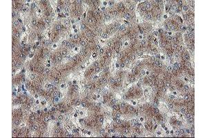 Image no. 7 for anti-Diphthamide Biosynthesis Protein 2 (DPH2) antibody (ABIN1497893) (DPH2 anticorps)