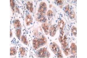 DAB staining on IHC-P; Samples: Human Stomach Tissue. (IFNA5 anticorps  (AA 22-189))