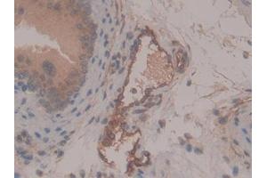 DAB staining on IHC-P; Samples: Mouse Testis Tissue
