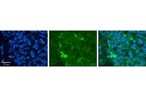 Rabbit Anti-PRDX2 Antibody     Formalin Fixed Paraffin Embedded Tissue: Human Pineal Tissue  Observed Staining: Cytoplasmic in cell bodies and processes of pinealocytes  Primary Antibody Concentration: 1:100  Other Working Concentrations: 1/600  Secondary Antibody: Donkey anti-Rabbit-Cy3  Secondary Antibody Concentration: 1:200  Magnification: 20X  Exposure Time: 0. (Peroxiredoxin 2 anticorps  (Middle Region))