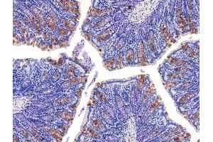 ABIN7094662 and ABIN7098713 at 1/100 staining Rat colorectal tissue by IHC-P.