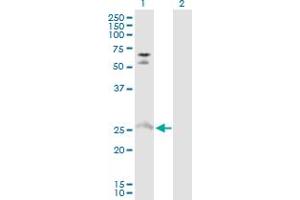 Western Blot analysis of MYO3A expression in transfected 293T cell line by MYO3A MaxPab polyclonal antibody. (MYO3A anticorps  (AA 1-247))