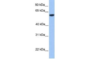 WB Suggested Anti-ZNF545 Antibody Titration: 0. (Zinc finger protein 82 homolog (ZFP82) (C-Term) anticorps)