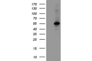 Image no. 1 for anti-Meis Homeobox 3 (MEIS3) (AA 1-261) antibody (ABIN1490668) (MEIS3 anticorps  (AA 1-261))