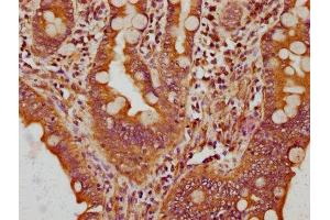 IHC image of ABIN7148519 diluted at 1:200 and staining in paraffin-embedded human small intestine tissue performed on a Leica BondTM system.