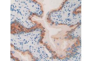 Used in DAB staining on fromalin fixed paraffin- embedded Kidney tissue (HAP1 anticorps  (AA 132-328))