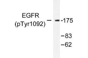 Image no. 1 for anti-Epidermal Growth Factor Receptor (EGFR) (pTyr1092) antibody (ABIN318011) (EGFR anticorps  (pTyr1092))