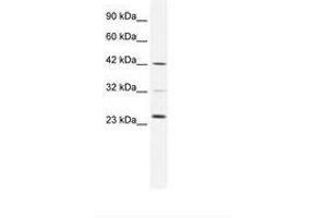 Image no. 1 for anti-E2F Transcription Factor 1 (E2F1) (C-Term) antibody (ABIN6735966) (E2F1 anticorps  (C-Term))