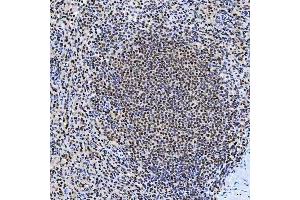 IHC analysis of SNRNP200 using anti-SNRNP200 antibody (ABIN7602032).