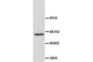 Western blot analysis of rat brain tissue lysis using ABI-1 antibody (ABI1 anticorps  (C-Term))