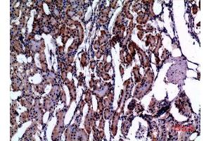 Immunohistochemistry (IHC) analysis of paraffin-embedded Rat Kidney, antibody was diluted at 1:100.