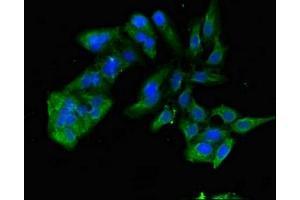Immunofluorescent analysis of Hela cells using ABIN7172340 at dilution of 1:100 and Alexa Fluor 488-congugated AffiniPure Goat Anti-Rabbit IgG(H+L)