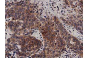 Immunohistochemical staining of paraffin-embedded Human Kidney tissue using anti-PRKD2 mouse monoclonal antibody.