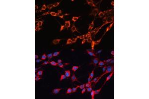 Immunofluorescence analysis of NIH/3T3 cells using SLC25 antibody (ABIN6132661, ABIN6147921, ABIN6147922 and ABIN6215721) at dilution of 1:100. (SLC25A24 anticorps  (AA 1-200))