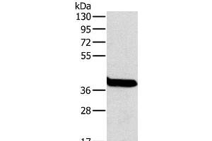 Western Blot analysis of Mouse liver tissue using OTC Polyclonal Antibody at dilution of 1:800 (OTC anticorps)