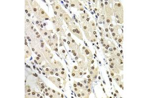 Immunohistochemistry of paraffin-embedded human stomach using SOX5 antibody at dilution of 1:100 (x400 lens). (SOX5 anticorps)