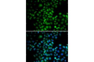 Immunofluorescence analysis of HeLa cells using C11orf30 antibody. (EMSY anticorps)